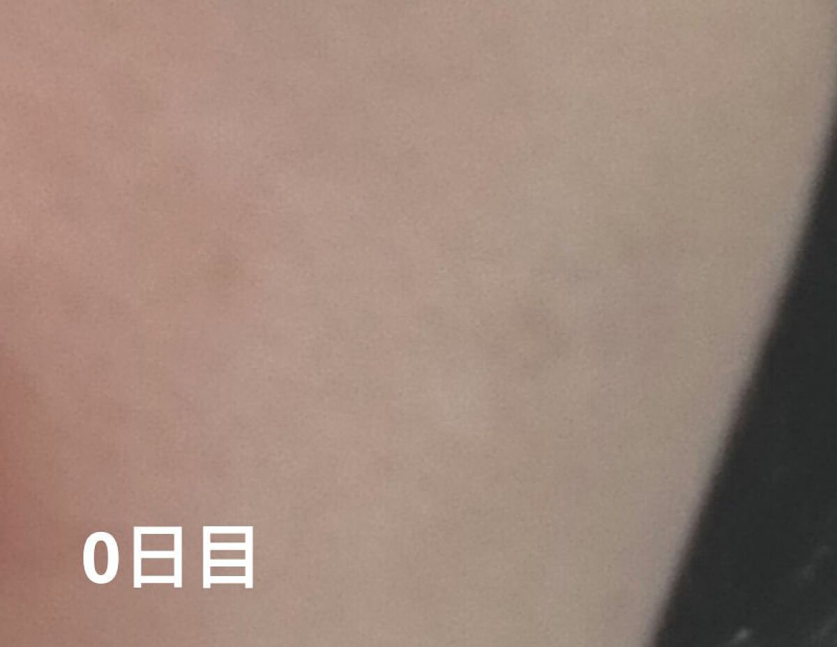 バランサートナー/ZO Skin Health/化粧水を使ったクチコミ（2枚目）