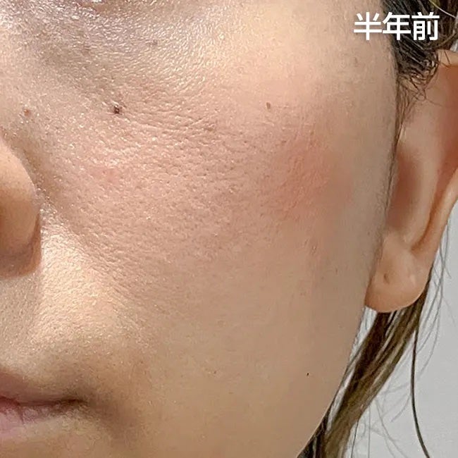 ケアセラ APフェイス&ボディ乳液/ケアセラ/ボディミルクを使ったクチコミ(4枚目)