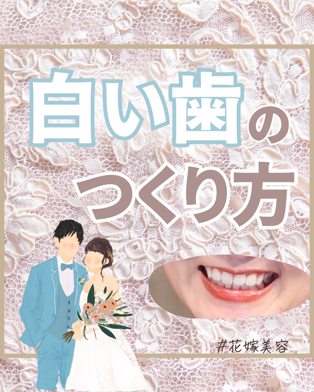 アパガードプレミオ/アパガード/歯磨き粉を使ったクチコミ（1枚目）