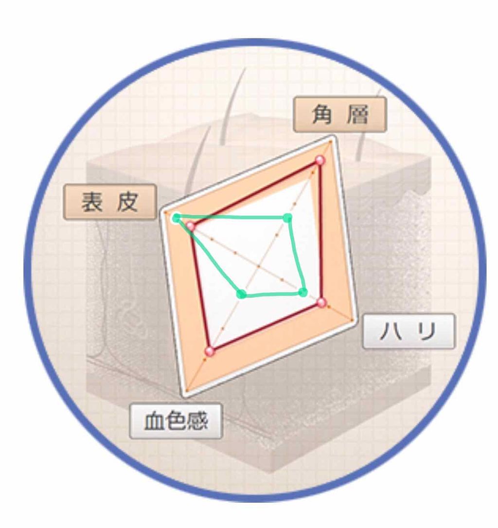 アクネケア エマルジョン R/d プログラム/乳液を使ったクチコミ(3枚目)