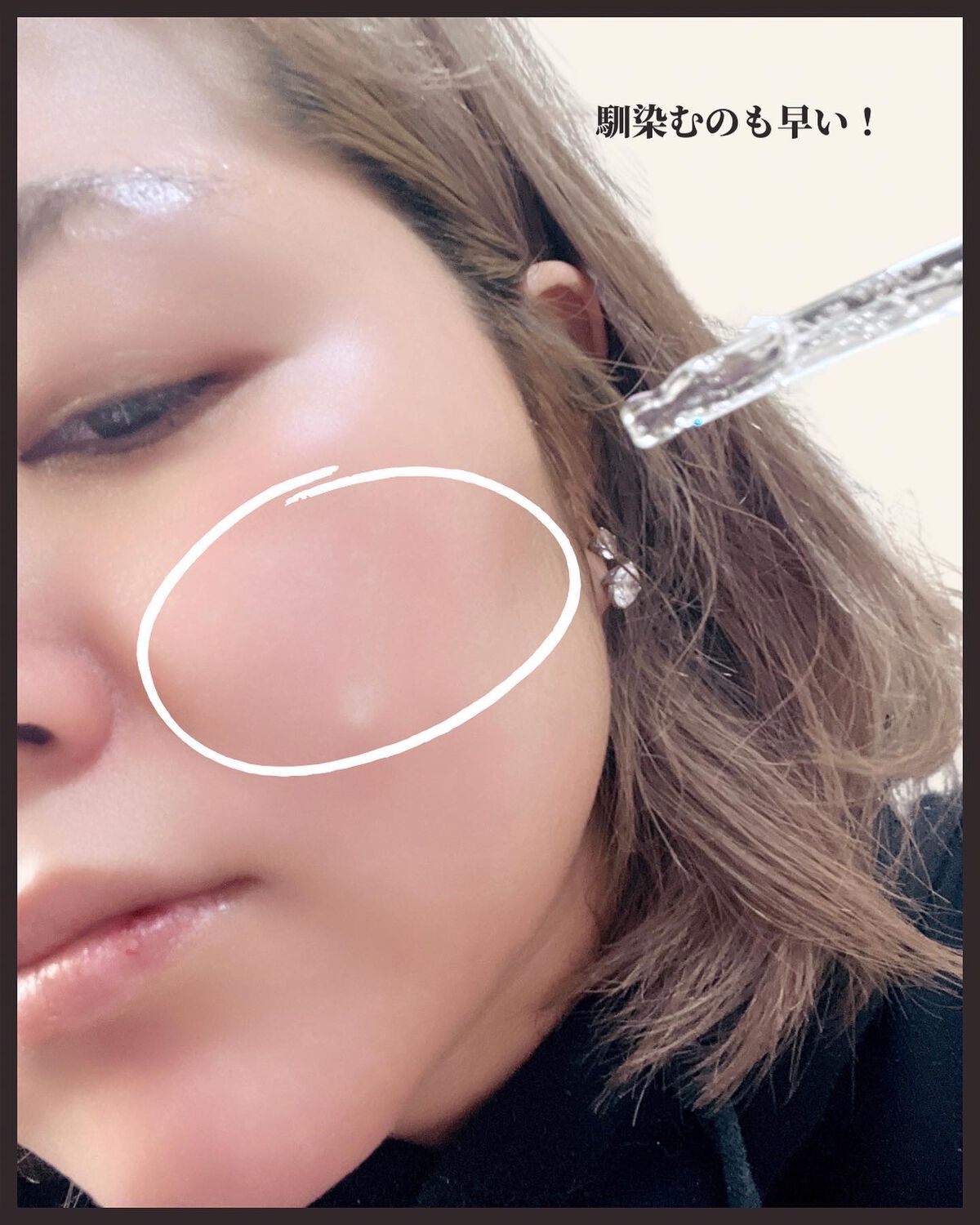 チェリーブロッサムブレミッシュ8GFセラム/Bring Back/化粧水を使ったクチコミ(4枚目)