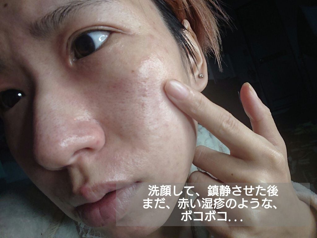 薬用しみ対策 美白化粧水 しっとりタイプ/メラノCC/化粧水を使ったクチコミ(2枚目)