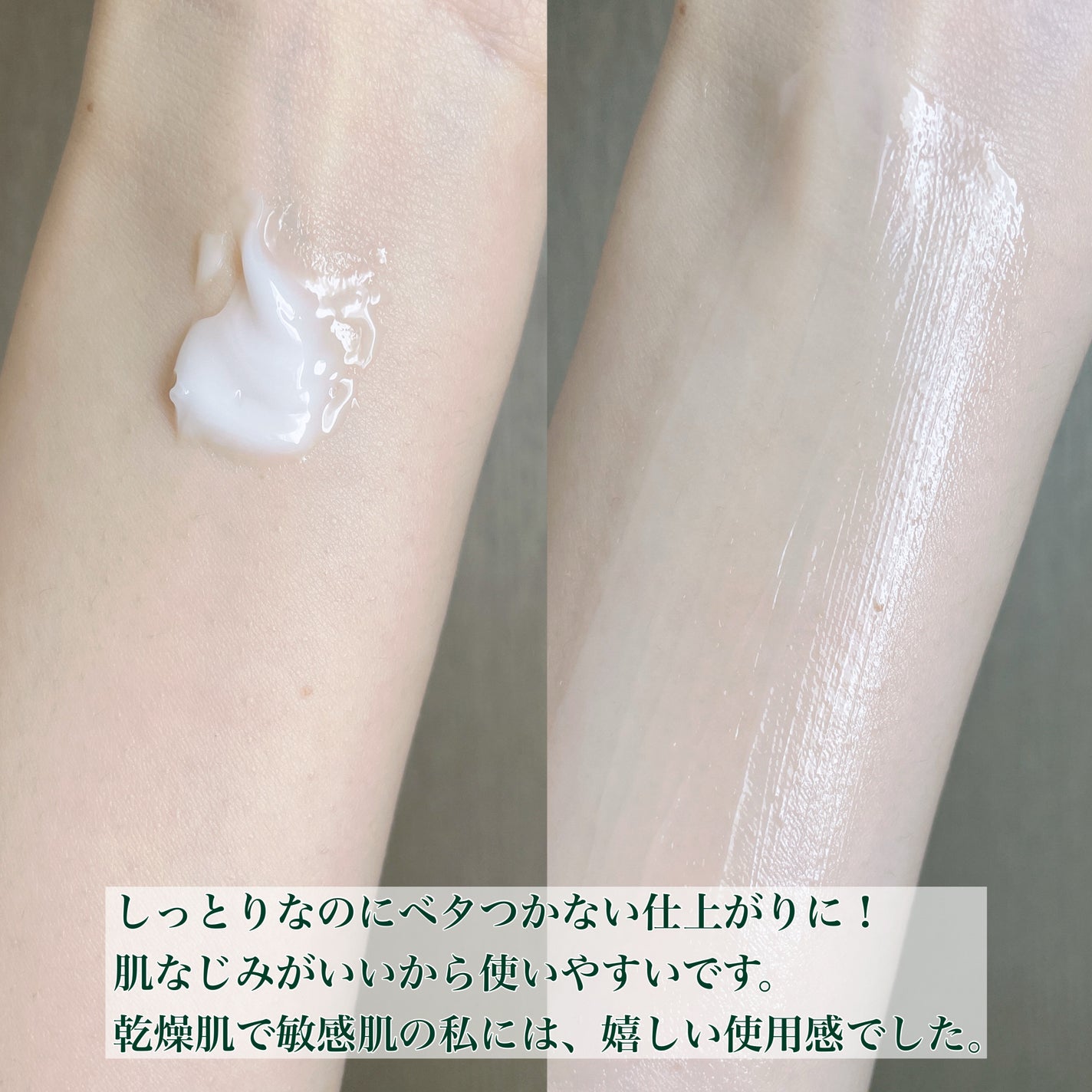 レッドブレミッシュ クリアモイスチャークリーム/Dr.G/フェイスクリームを使ったクチコミ(4枚目)