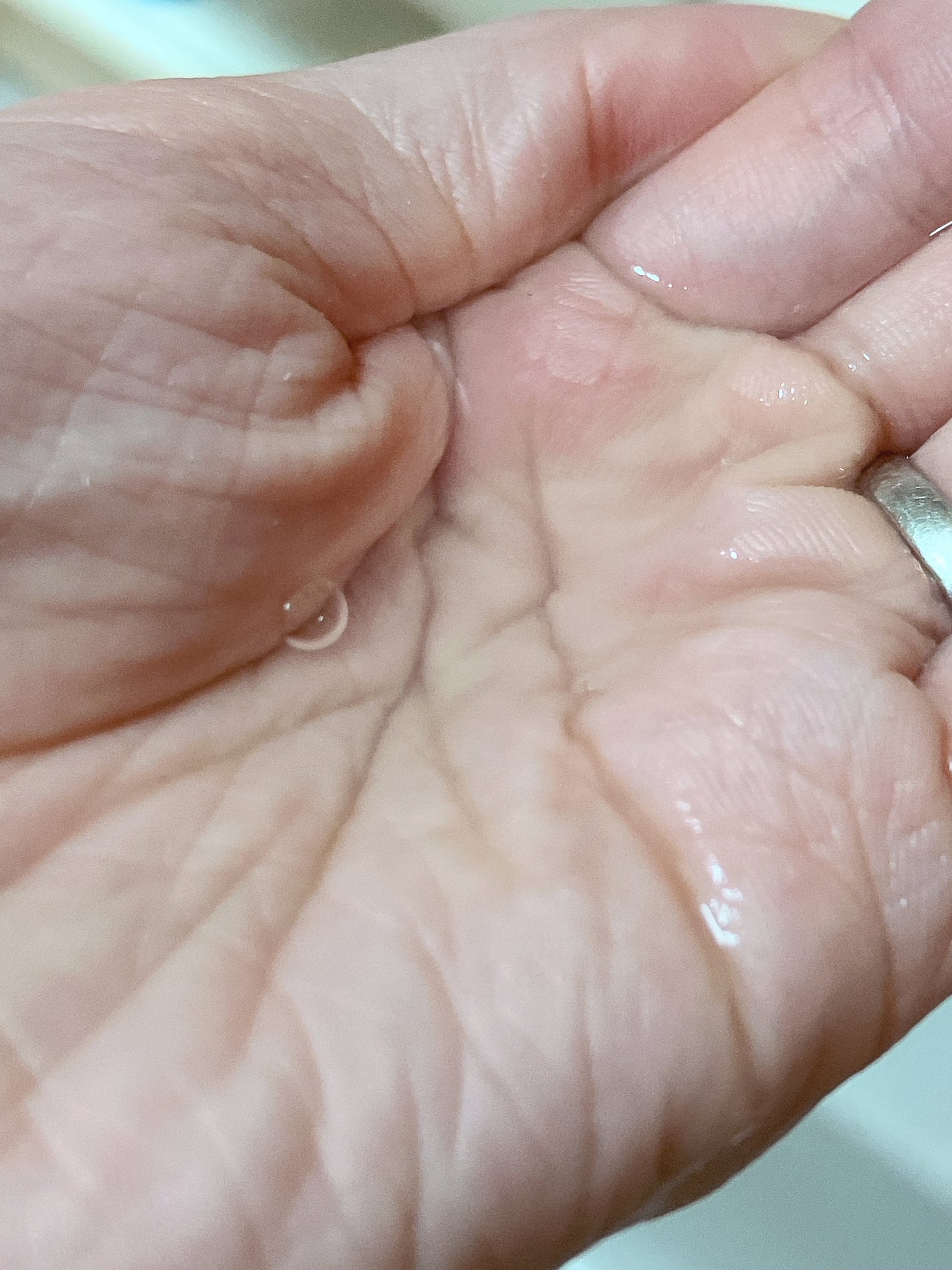 イドラクラリティ 薬用 トリートメント エッセンス ウォーター/DECORTÉ/化粧水を使ったクチコミ(3枚目)