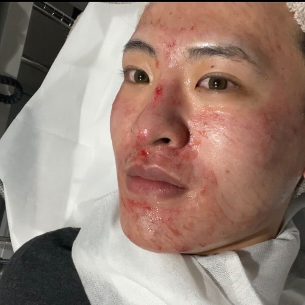 テラスキン/LINE REPAIR/美容液を使ったクチコミ（3枚目）