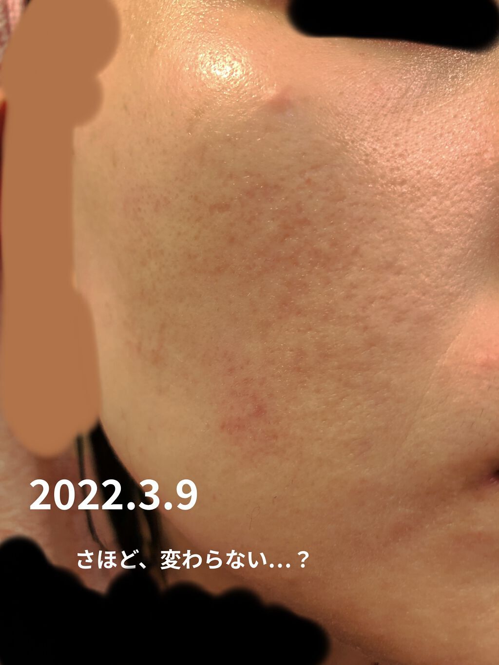 オルビスユー トライアルセット/オルビス/スキンケアキットを使ったクチコミ（2枚目）