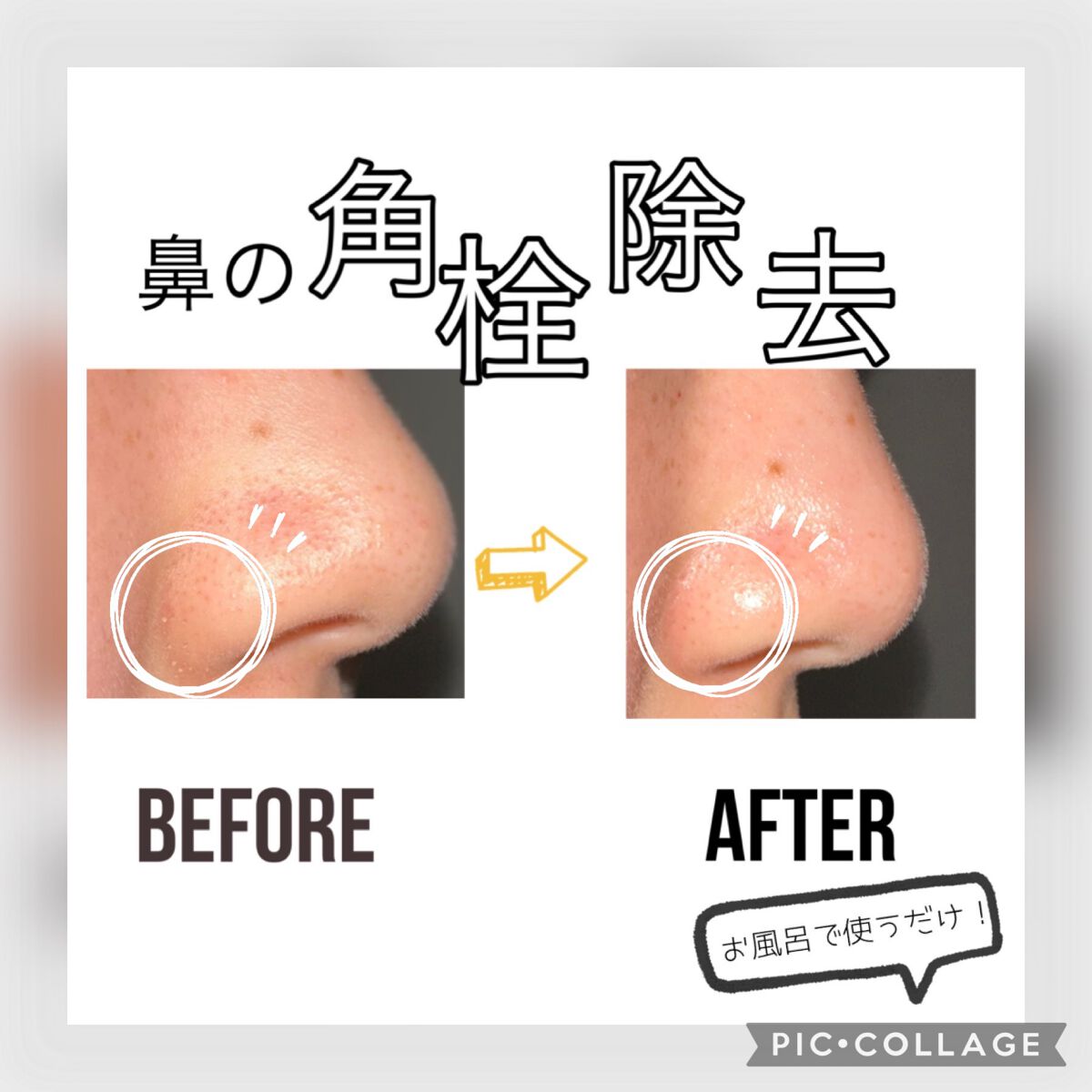 おうちdeエステ 肌をなめらかにするマッサージ洗顔ジェル 炭/ビオレ/その他洗顔料を使ったクチコミ（1枚目）