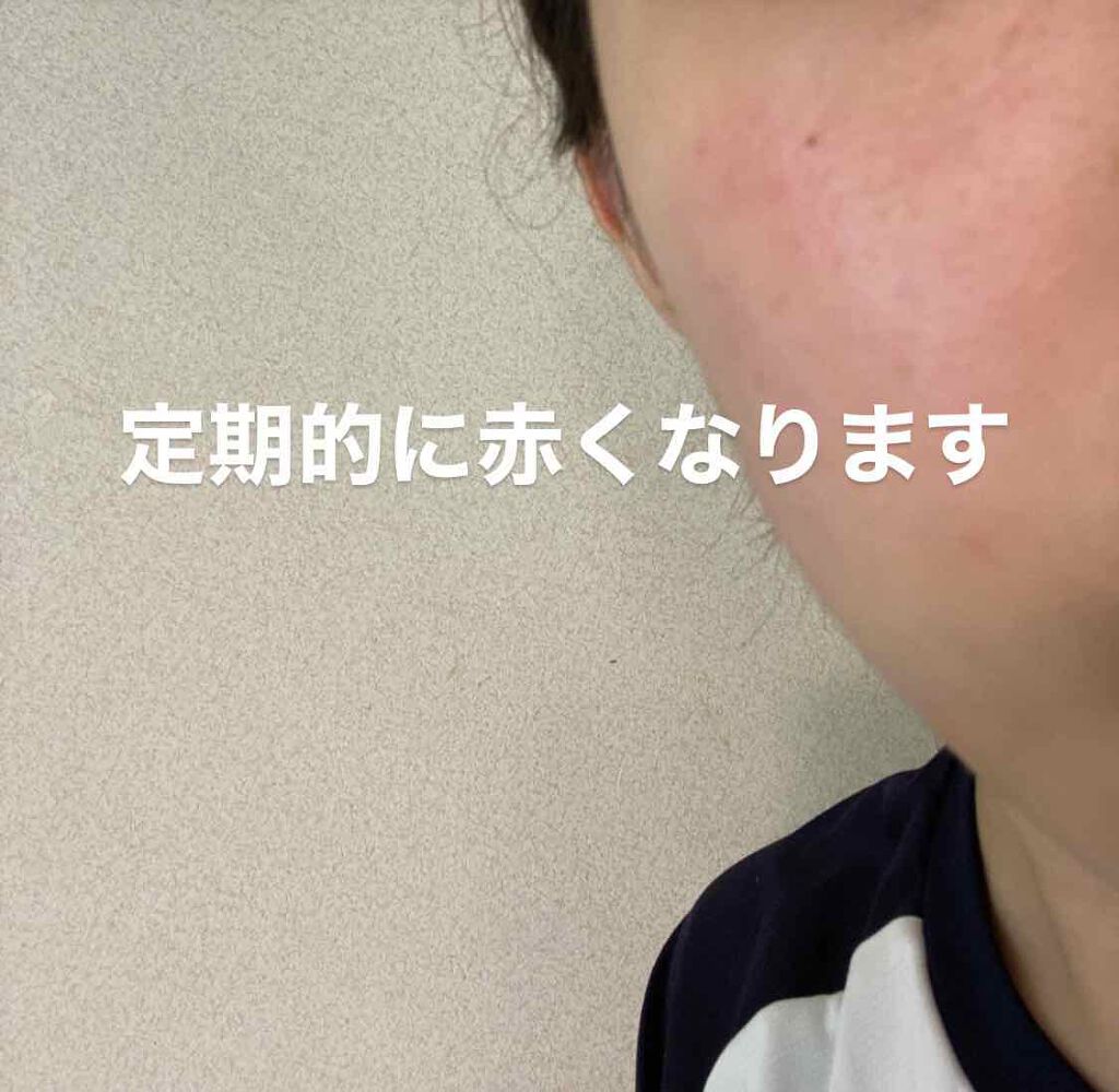 ハトムギ化粧水(ナチュリエ スキンコンディショナー R )/ナチュリエ/化粧水を使ったクチコミ（1枚目）