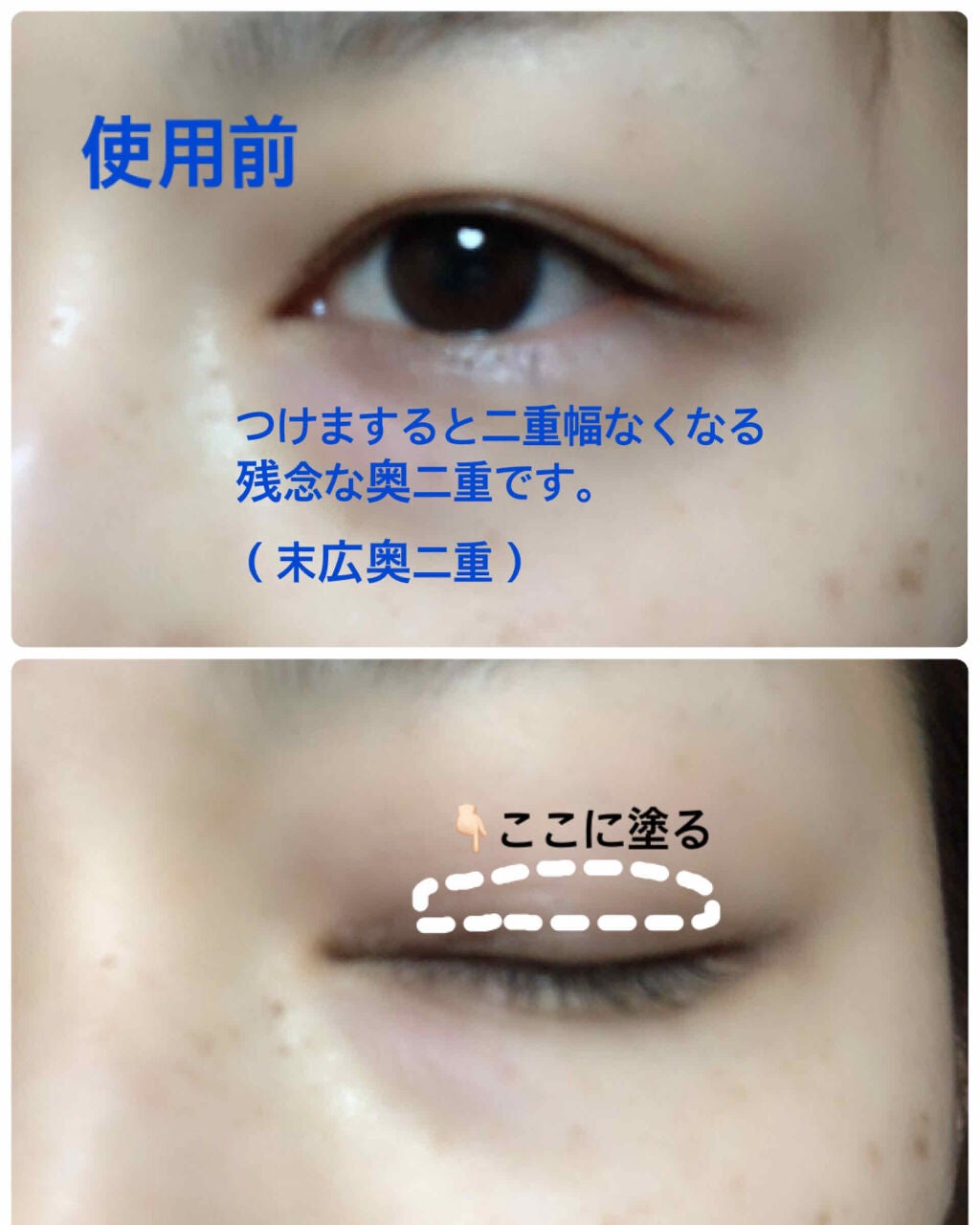 【旧品】オリシキ アイリッドスキンフィルム/D-UP/二重まぶた用アイテムを使ったクチコミ(2枚目)