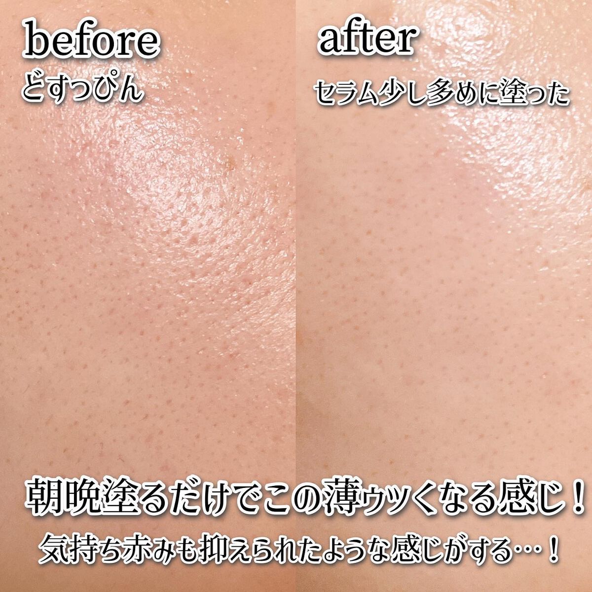 ゼロ毛穴1DAYセラム/MEDICUBE/美容液を使ったクチコミ(4枚目)