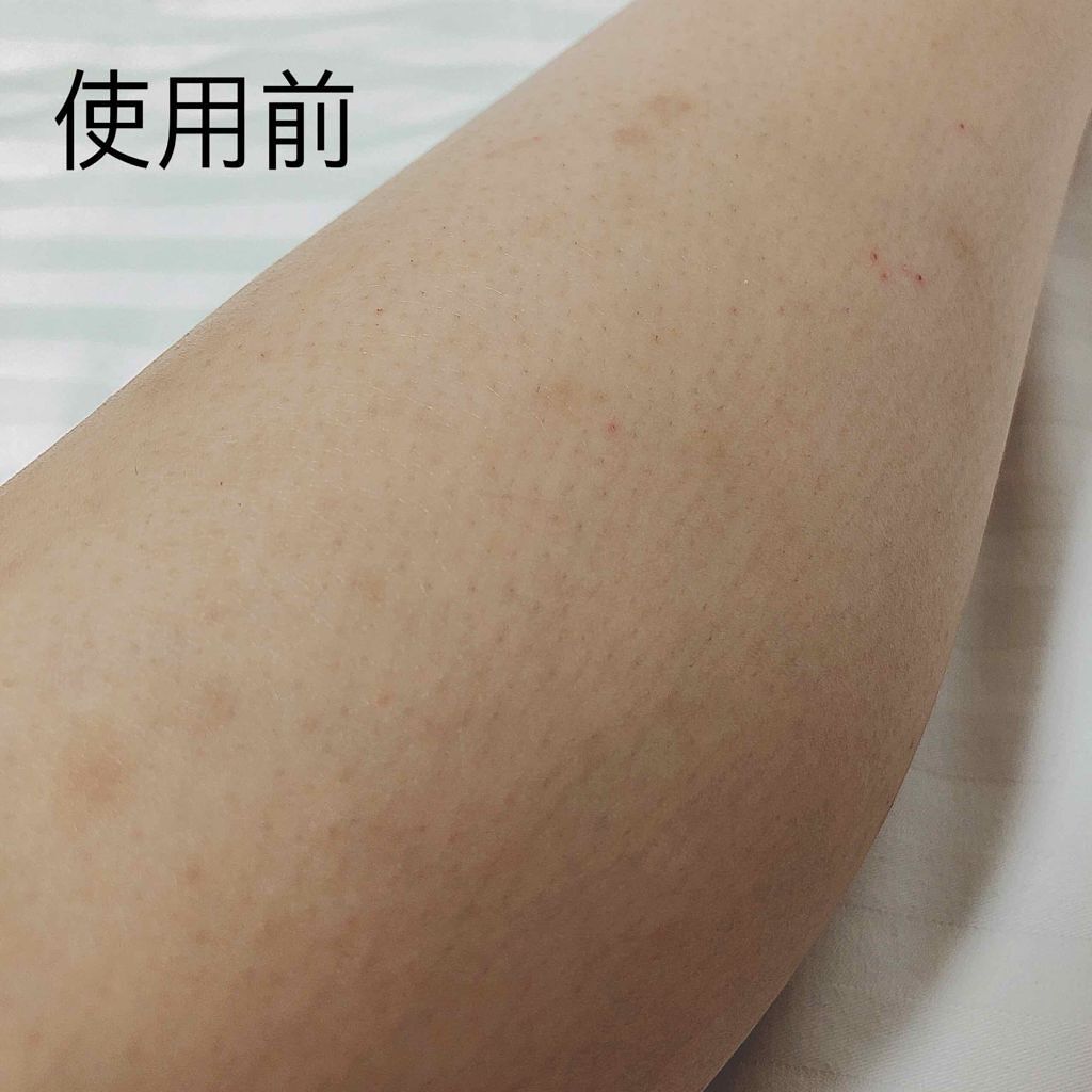 ケアノキュア(医薬品)/小林製薬/その他を使ったクチコミ(2枚目)