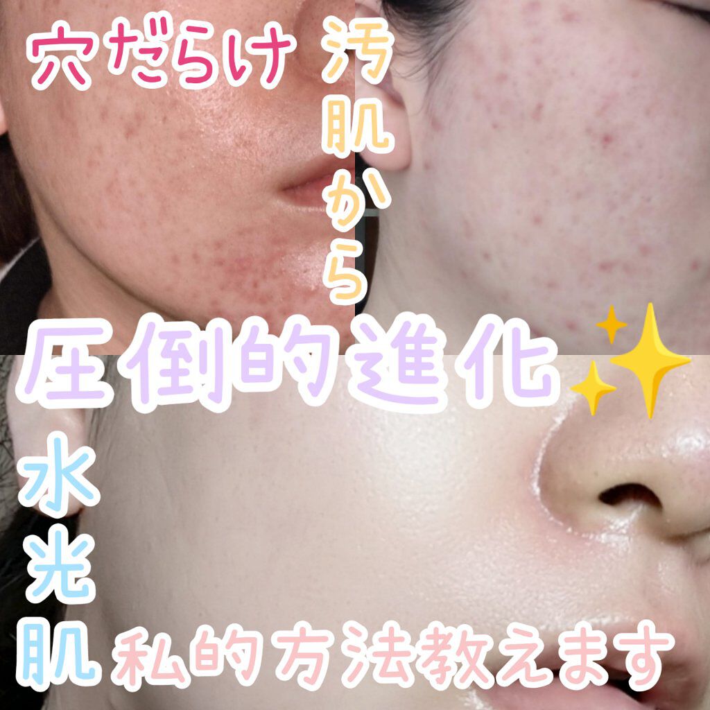 敏感肌な研究者 あすか On Lips 今回は汚肌を卒業した私が 今も続けるパックの仕方をご紹介します Lips