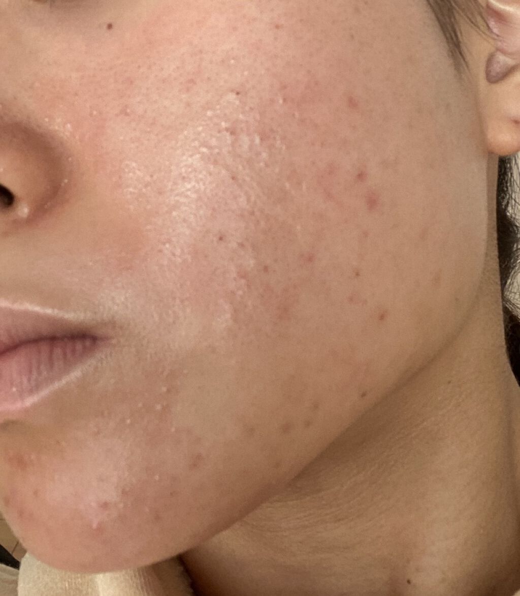 マデカクリーム/センテリアン24/フェイスクリームを使ったクチコミ（1枚目）