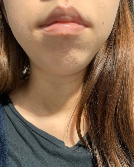 38°C / 99°F リップトリートメント (リップ美容液)/UZU BY FLOWFUSHI/リップケアを使ったクチコミ(4枚目)