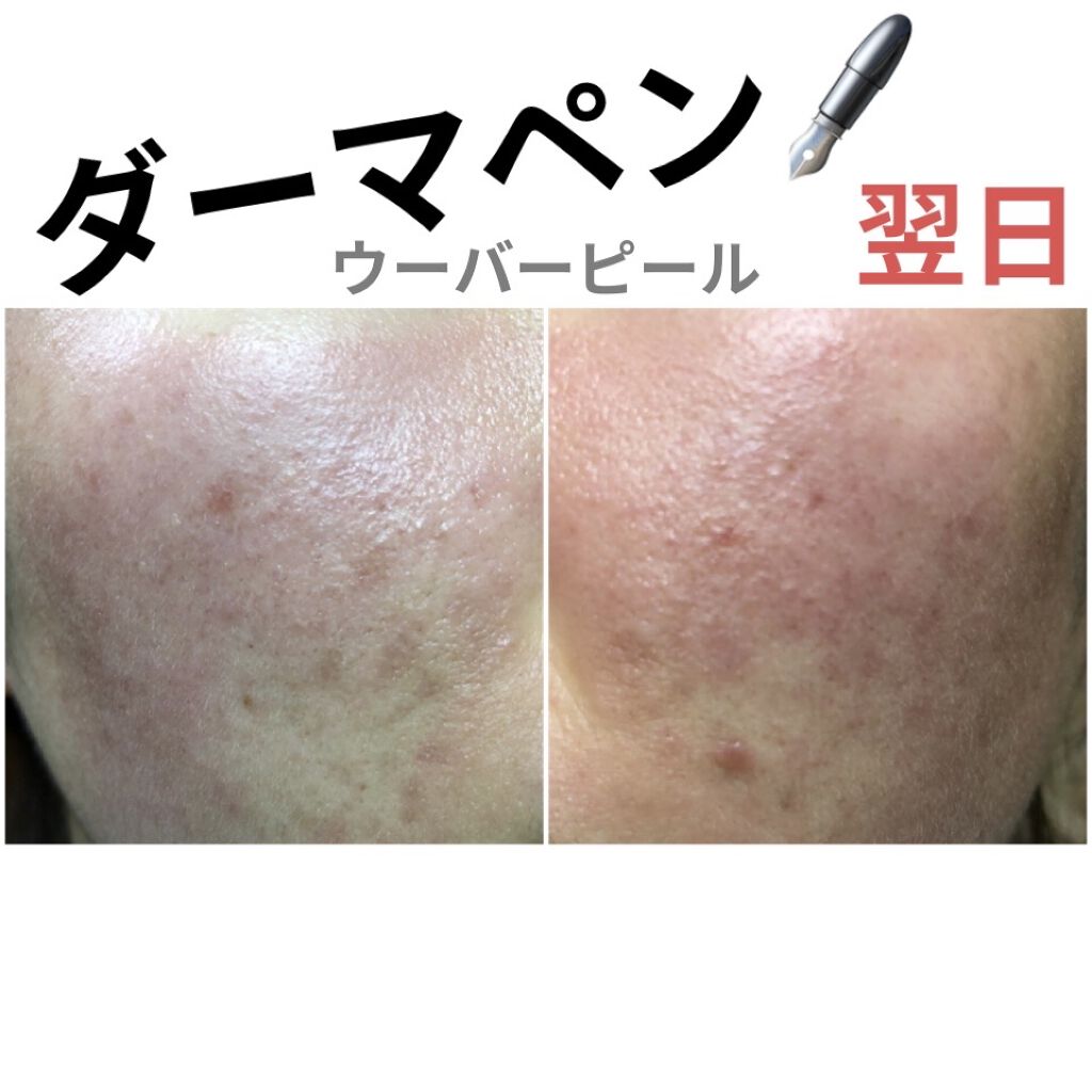 オリジナル ピュアスキンジェリー/ヴァセリン/ボディクリームを使ったクチコミ（1枚目）