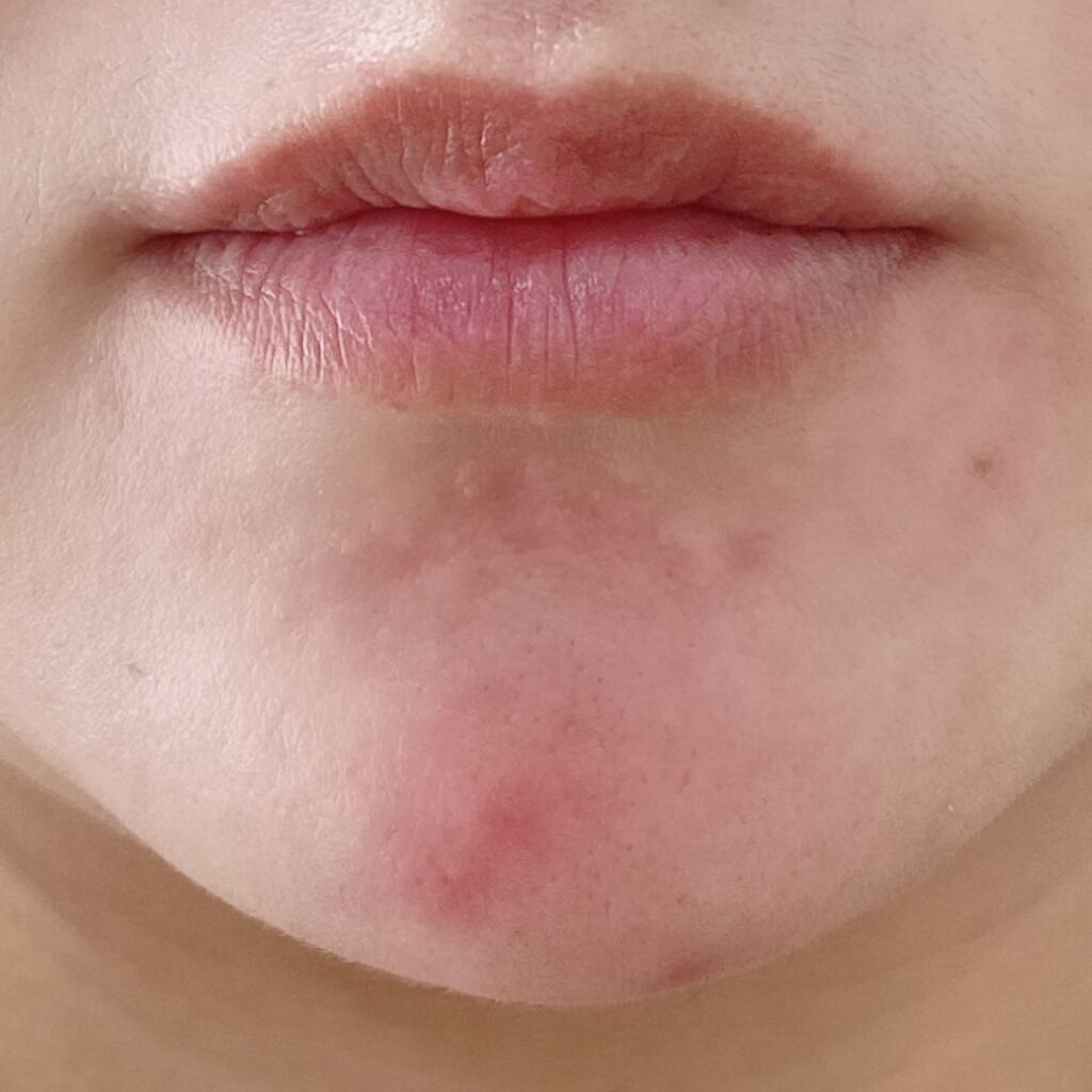 キル カバー フィクサー クッション/CLIO/クッションファンデーションを使ったクチコミ(5枚目)