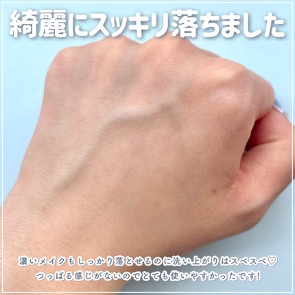 夢みるバーム アクネクリアモイスチャー/ロゼット/クレンジングバームを使ったクチコミ(6枚目)