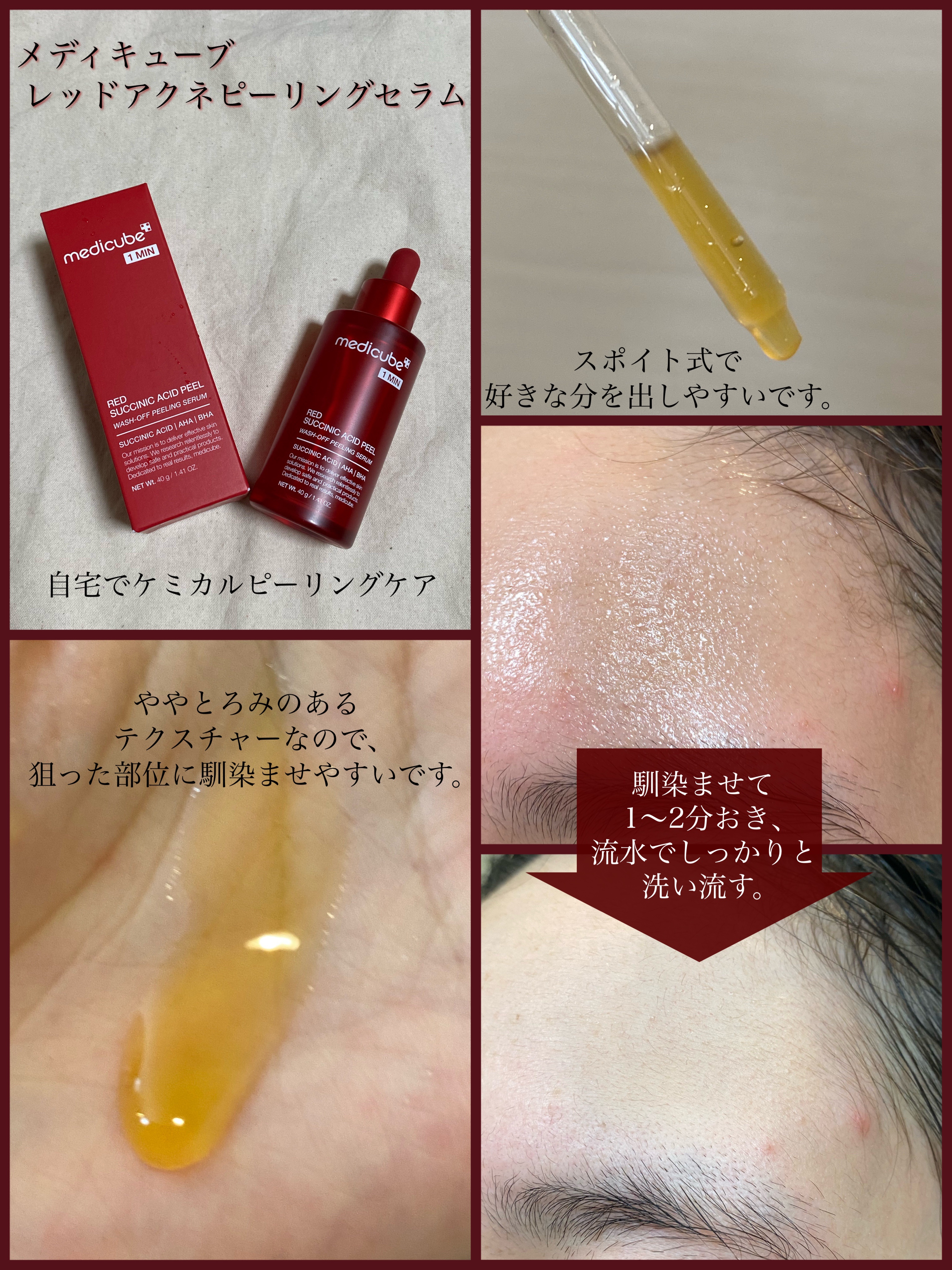 レッドアクネピーリングセラム/MEDICUBE/美容液を使ったクチコミ（1枚目）