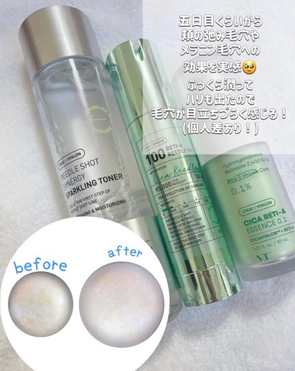 シカレチA エッセンス0.1/VT/美容液を使ったクチコミ(5枚目)