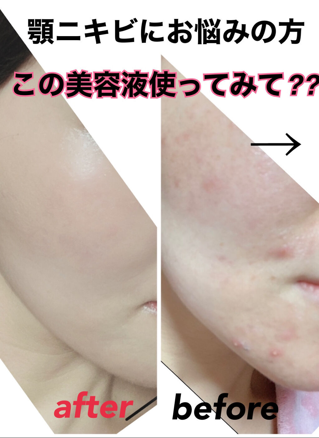 セラム ヴェール/ONE BY KOSE/美容液を使ったクチコミ（1枚目）