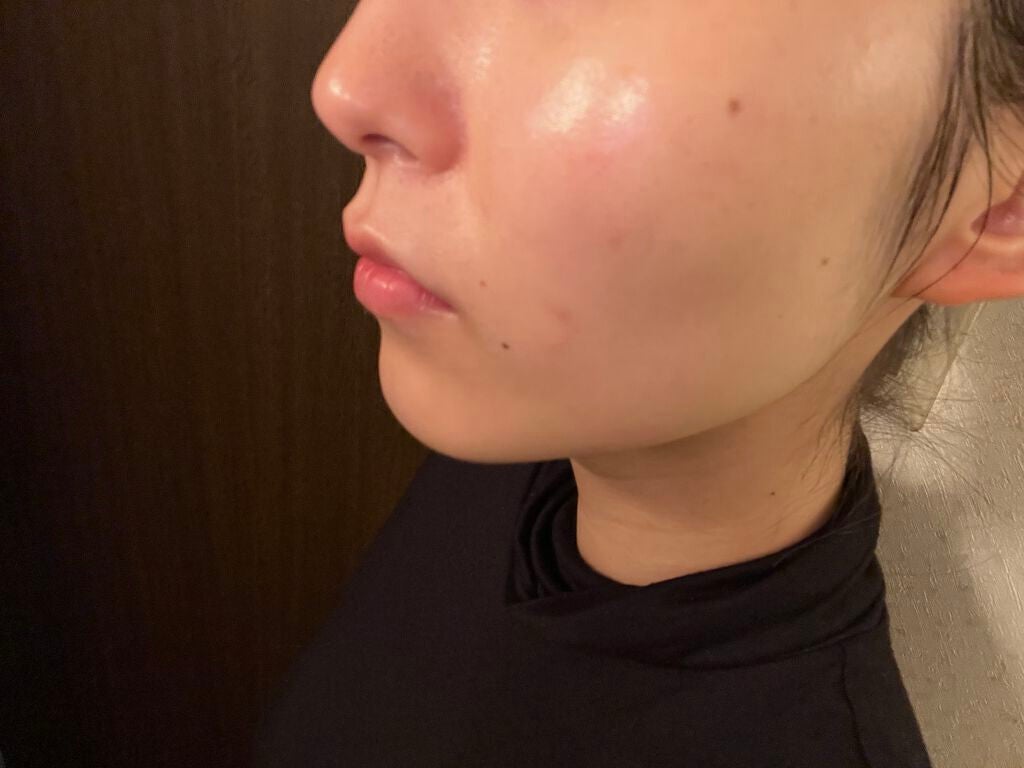 CICA スキン/VT/化粧水を使ったクチコミ(6枚目)