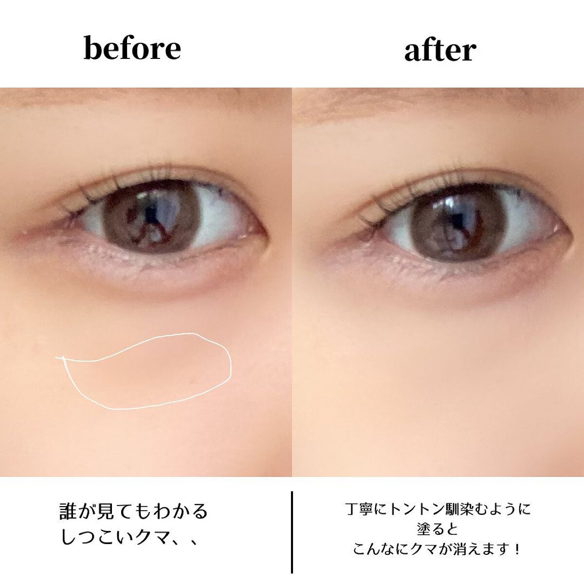 カバーパーフェクション チップコンシーラー/the SAEM/リキッドコンシーラーを使ったクチコミ(3枚目)