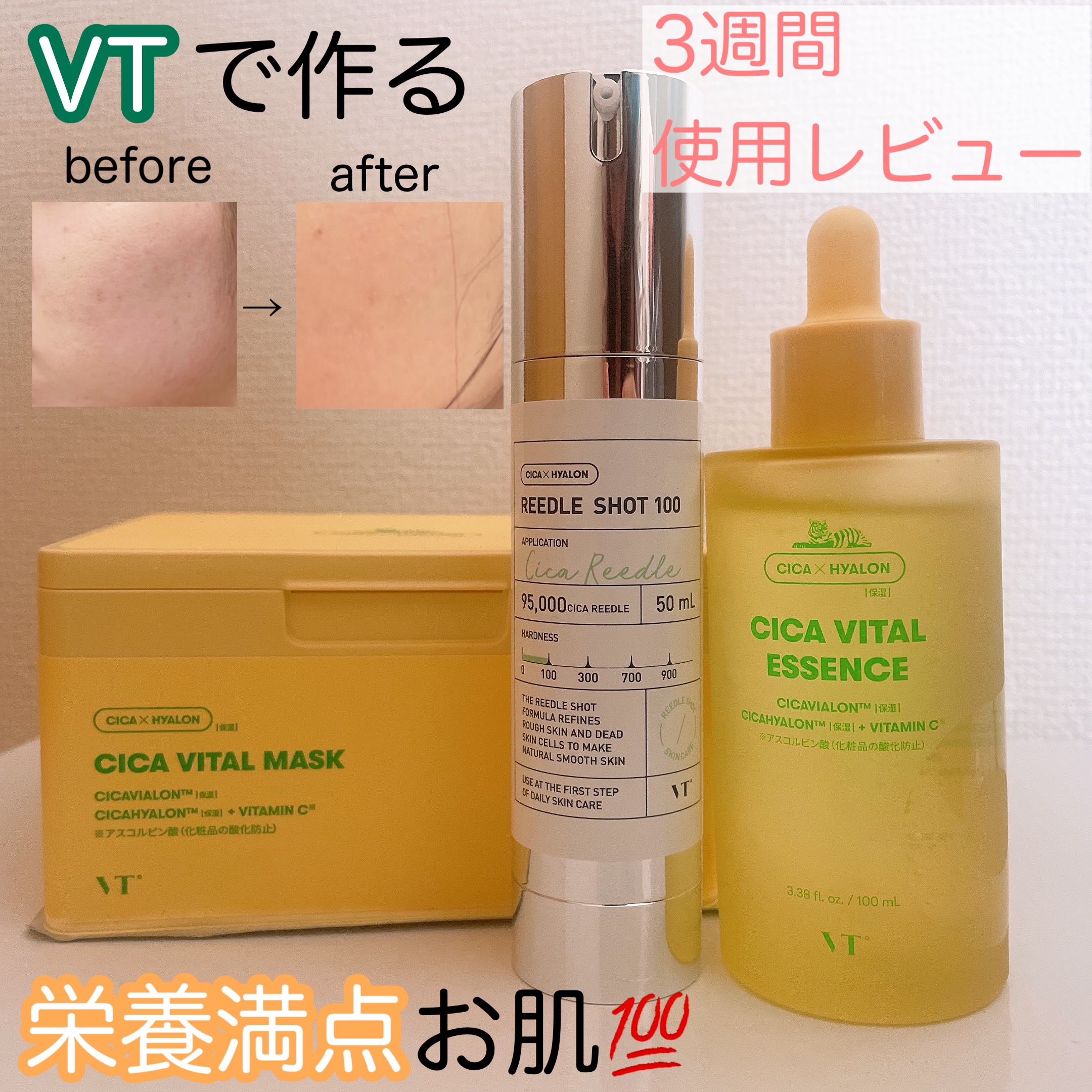 シカバイタル エッセンス/VT/美容液を使ったクチコミ（1枚目）