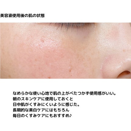 薬用 エフェクト リンクル&モイスト セラム/AMPULE SHOT/美容液を使ったクチコミ(6枚目)