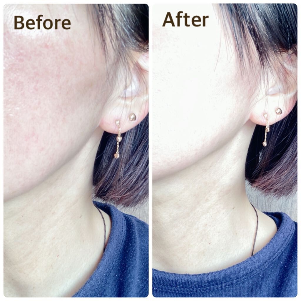 ピンクティーツリーカバークッション/APLIN/クッションファンデーションを使ったクチコミ(7枚目)