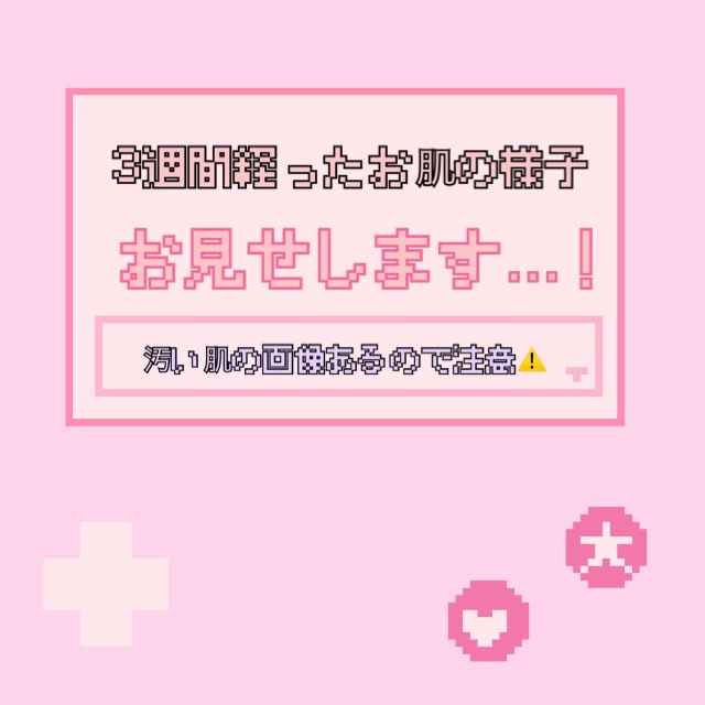 菊正宗 日本酒の化粧水 高保湿/菊正宗/化粧水を使ったクチコミ（1枚目）