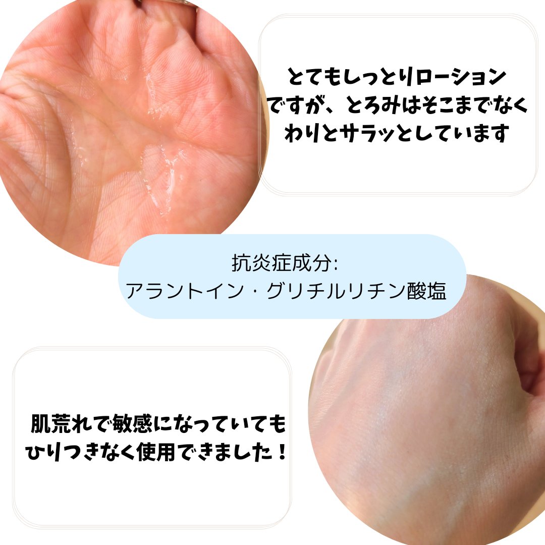 薬用ローション（とてもしっとり）/IHADA/化粧水を使ったクチコミ（3枚目）