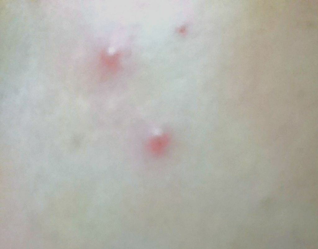 ロゼット洗顔パスタ アクネクリア/ロゼット/洗顔フォームを使ったクチコミ（3枚目）