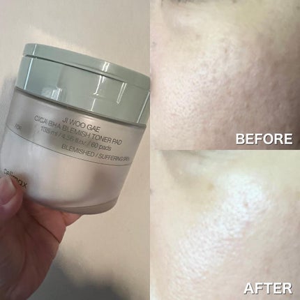 シカBHAフレミッシュトナーパット/celimax/クレンジングシートを使ったクチコミ(2枚目)