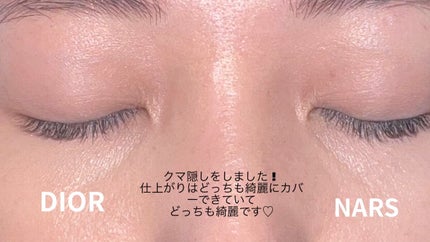 ラディアントクリーミーコンシーラー/NARS/リキッドコンシーラーを使ったクチコミ(4枚目)