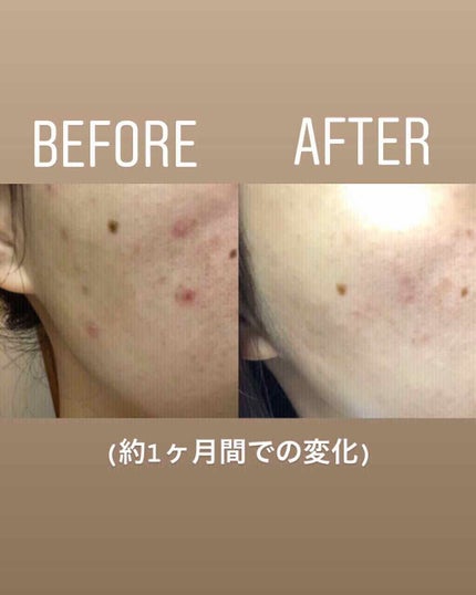 B-SALIC2.0 ASTAZET4.0/CHICAY CHICO/フェイスクリームを使ったクチコミ(3枚目)