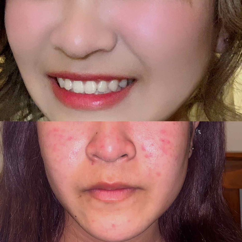 ハトムギ化粧水(ナチュリエ スキンコンディショナー R )/ナチュリエ/化粧水を使ったクチコミ(2枚目)