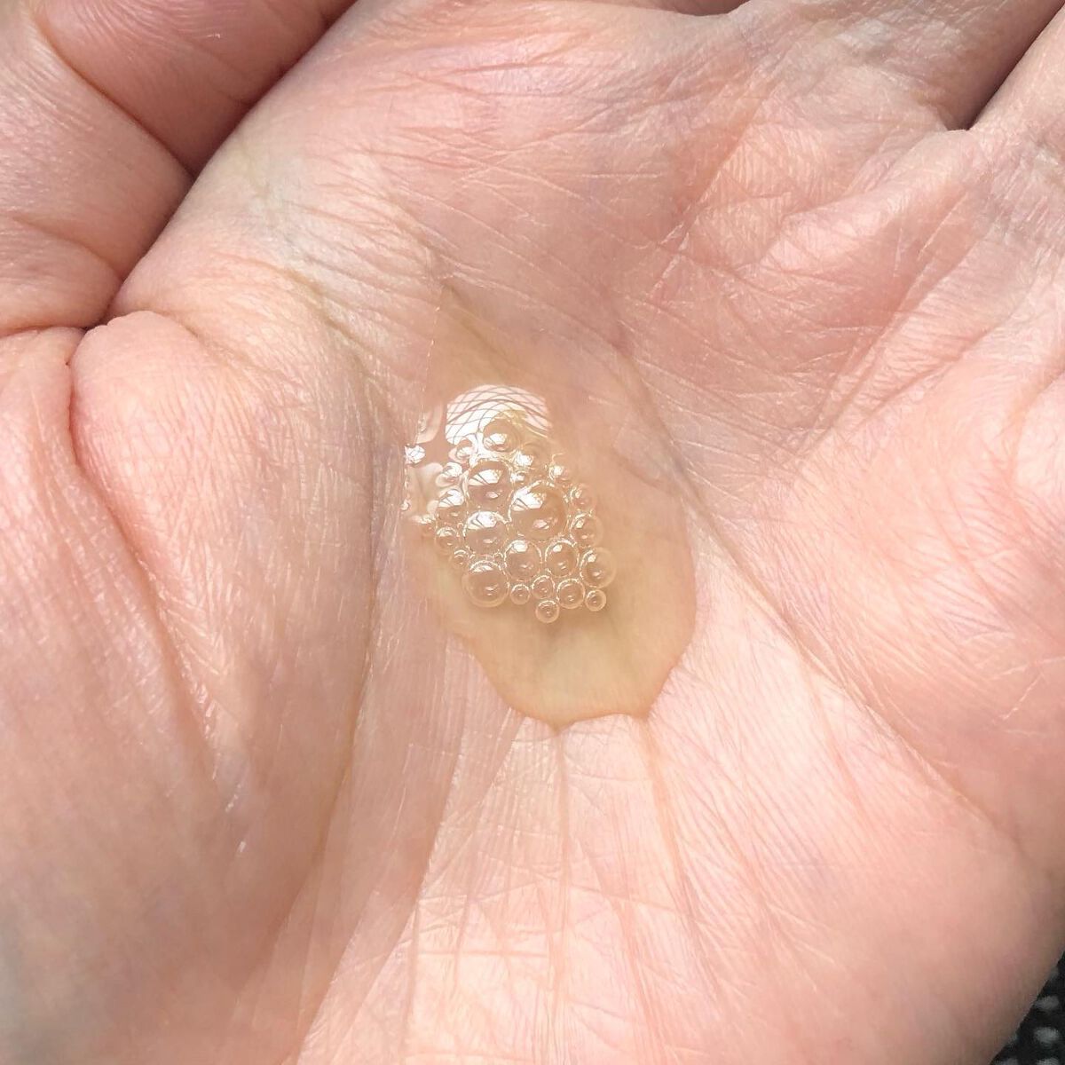 TX-アンプルクレンザー/Dr.Melaxin/美容液を使ったクチコミ(4枚目)