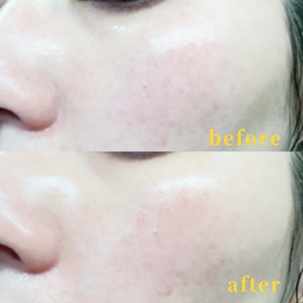 Peeling Ampoule 19.5/BeginS by JUNGSAEMMOOL/ピーリングを使ったクチコミ(3枚目)