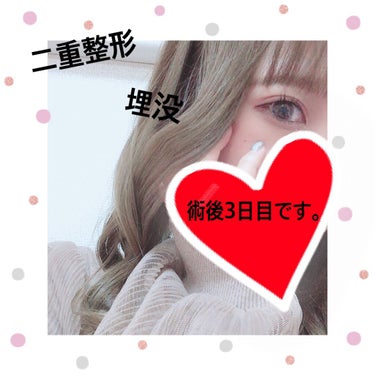 ♡. on LIPS 「👀💗二重整形💗👀術後3日目になりました😌正直変わった様子何もな..」（1枚目）