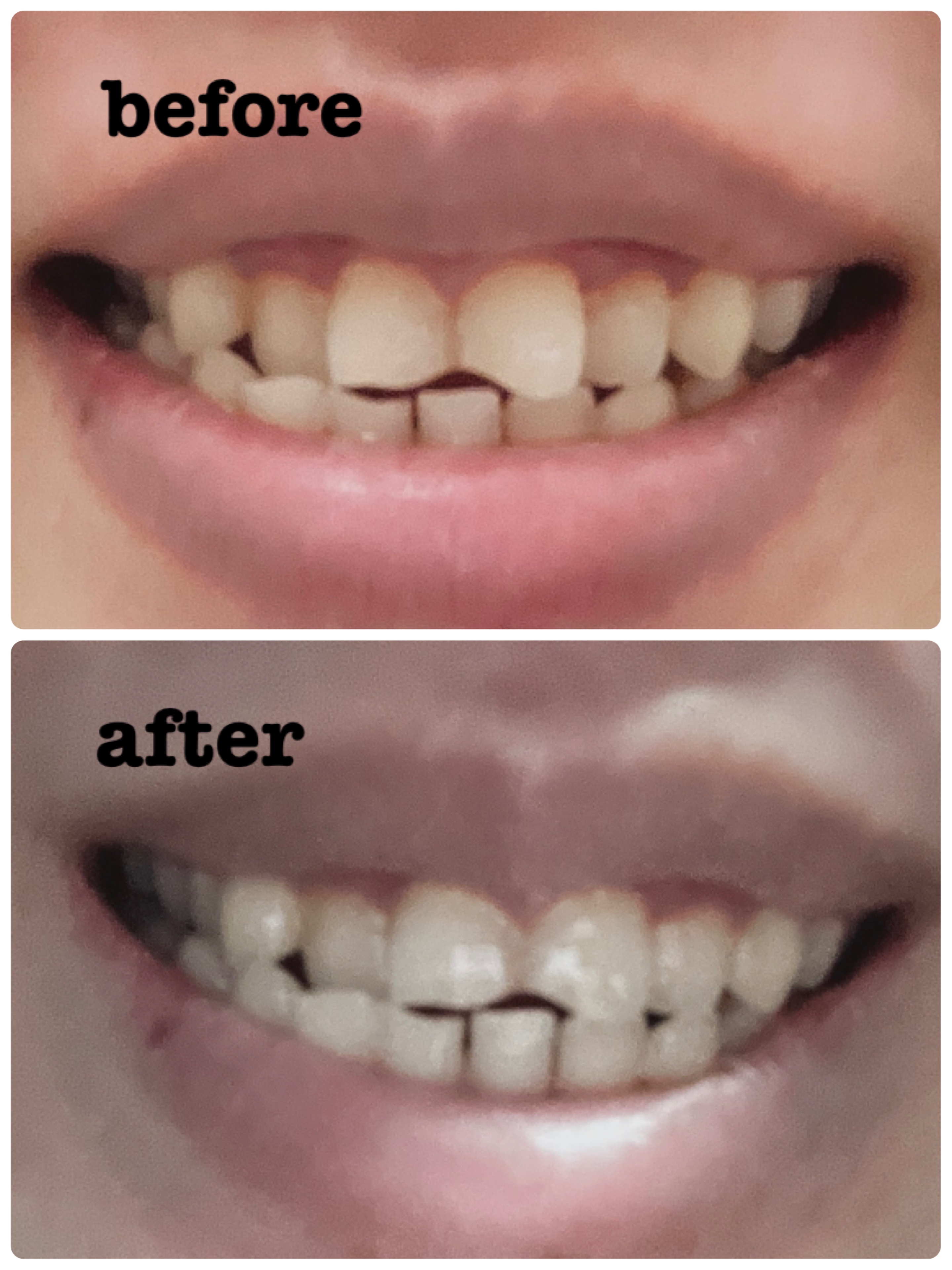 Reve Allbe Natural Tooth Gel /Allbe/歯磨き粉を使ったクチコミ（2枚目）