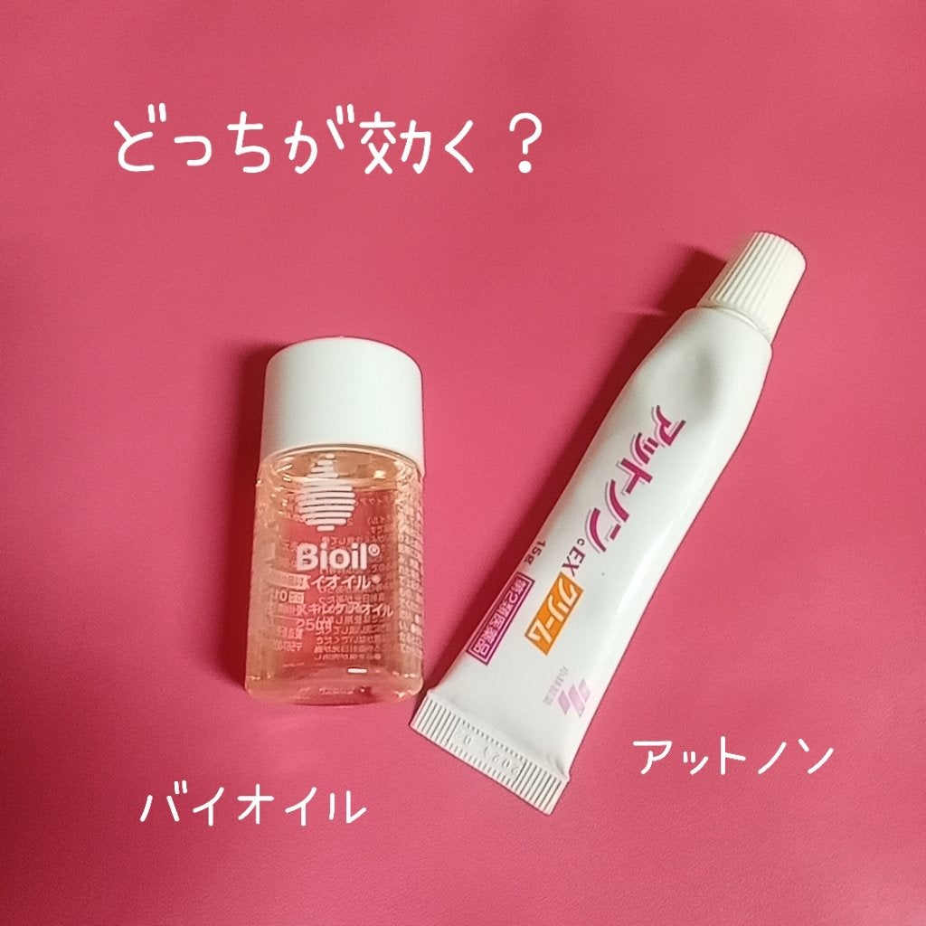 アットノン(医薬品)/アットノン/その他を使ったクチコミ(1枚目)