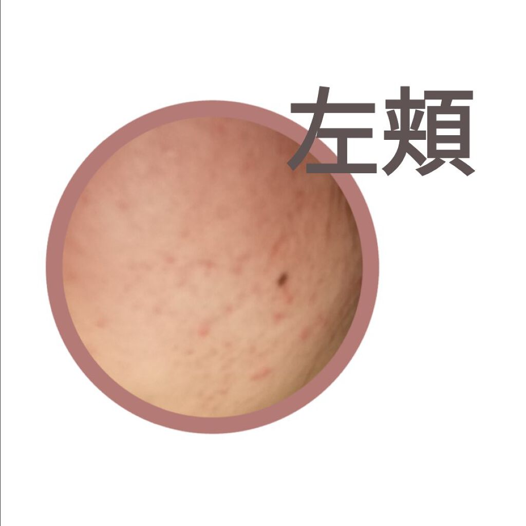 ハトムギ化粧水(ナチュリエ スキンコンディショナー R )/ナチュリエ/化粧水を使ったクチコミ（3枚目）