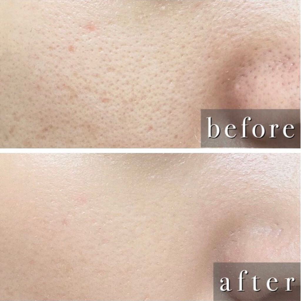 ナチュラルラディアント ロングウェア クッションファンデーション/NARS/クッションファンデーションを使ったクチコミ(5枚目)