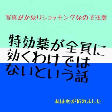 ディフェリンゲル0.1% /マルホ株式会社/その他を使ったクチコミ（1枚目）