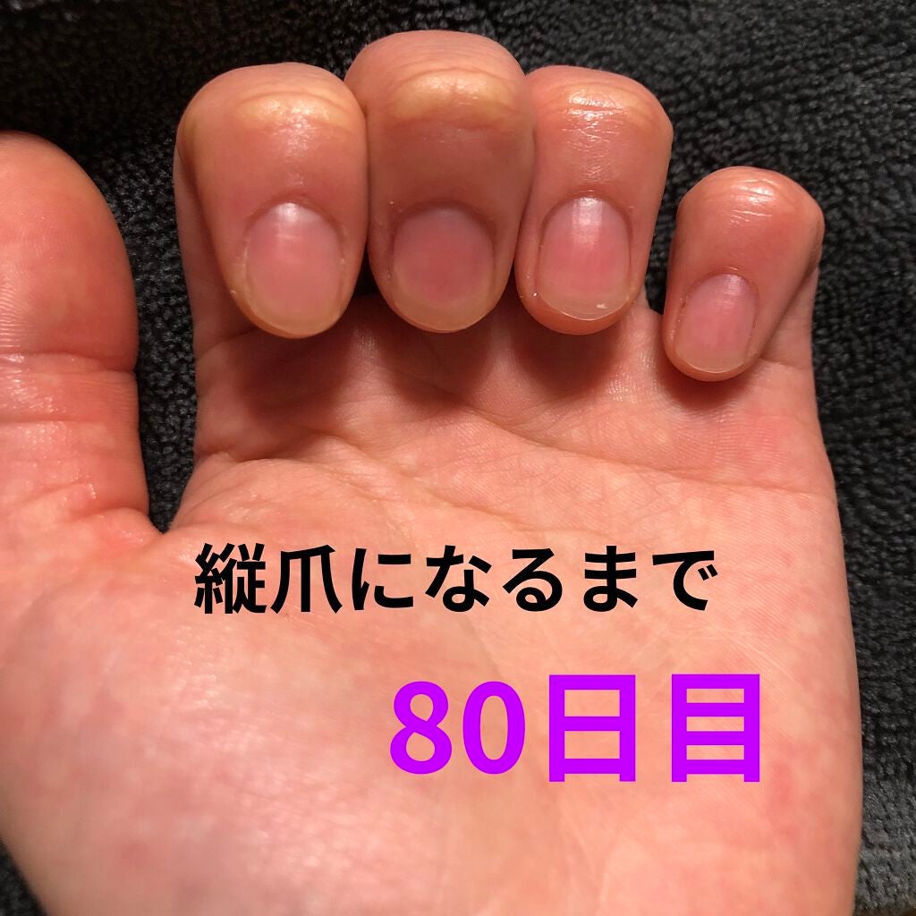 ð on LIPS ã瞊çªã«ãªãããã«ãããããªæ¹æ³ããã£ããæããŠãã ããð瞊çªã«..ãïŒ1æç®ïŒ