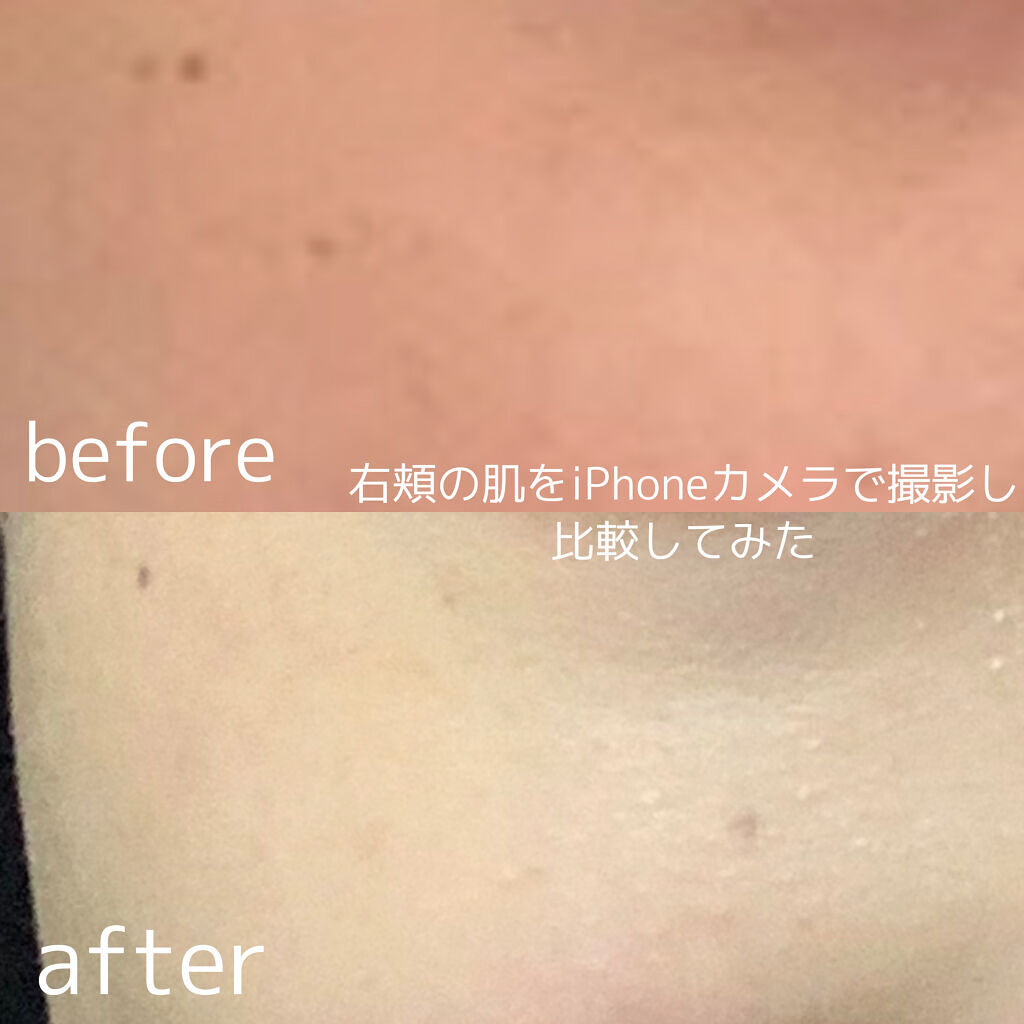 白潤 薬用美白化粧水/肌ラボ/化粧水を使ったクチコミ（1枚目）