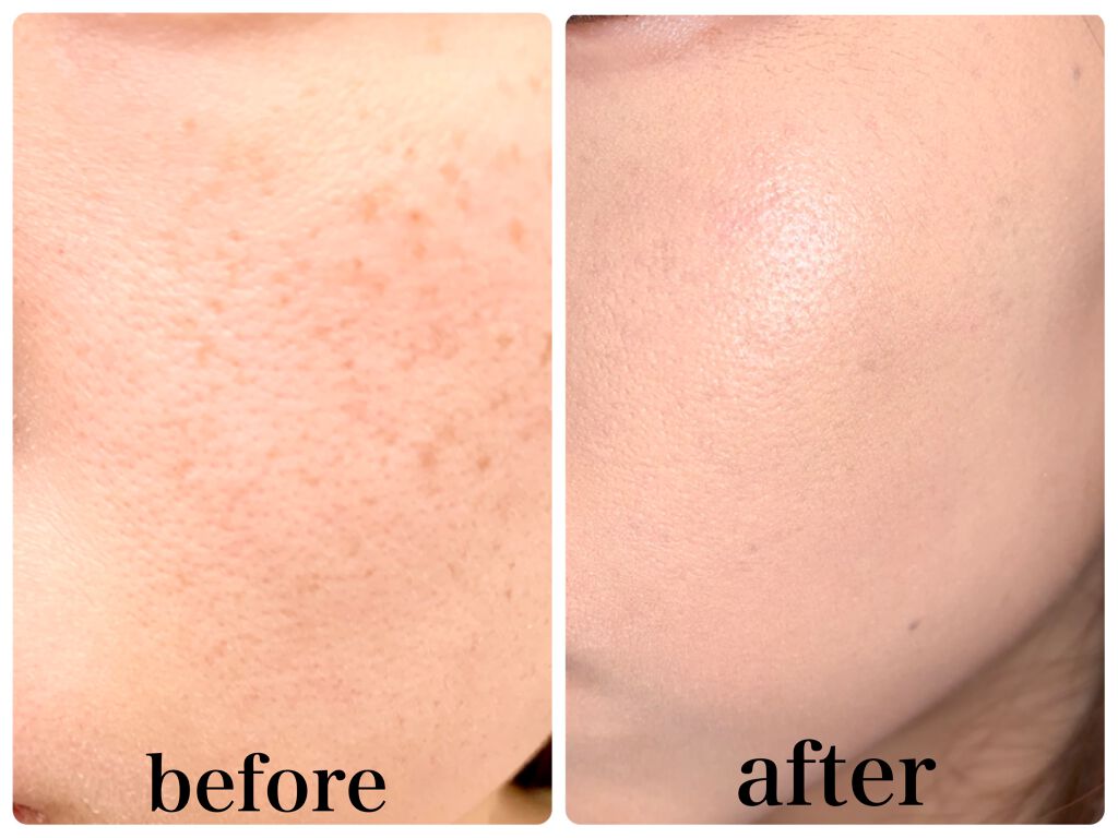 MAGIC CREAM/SERIOUS MODE/クリーム・エマルジョンファンデーションを使ったクチコミ（3枚目）