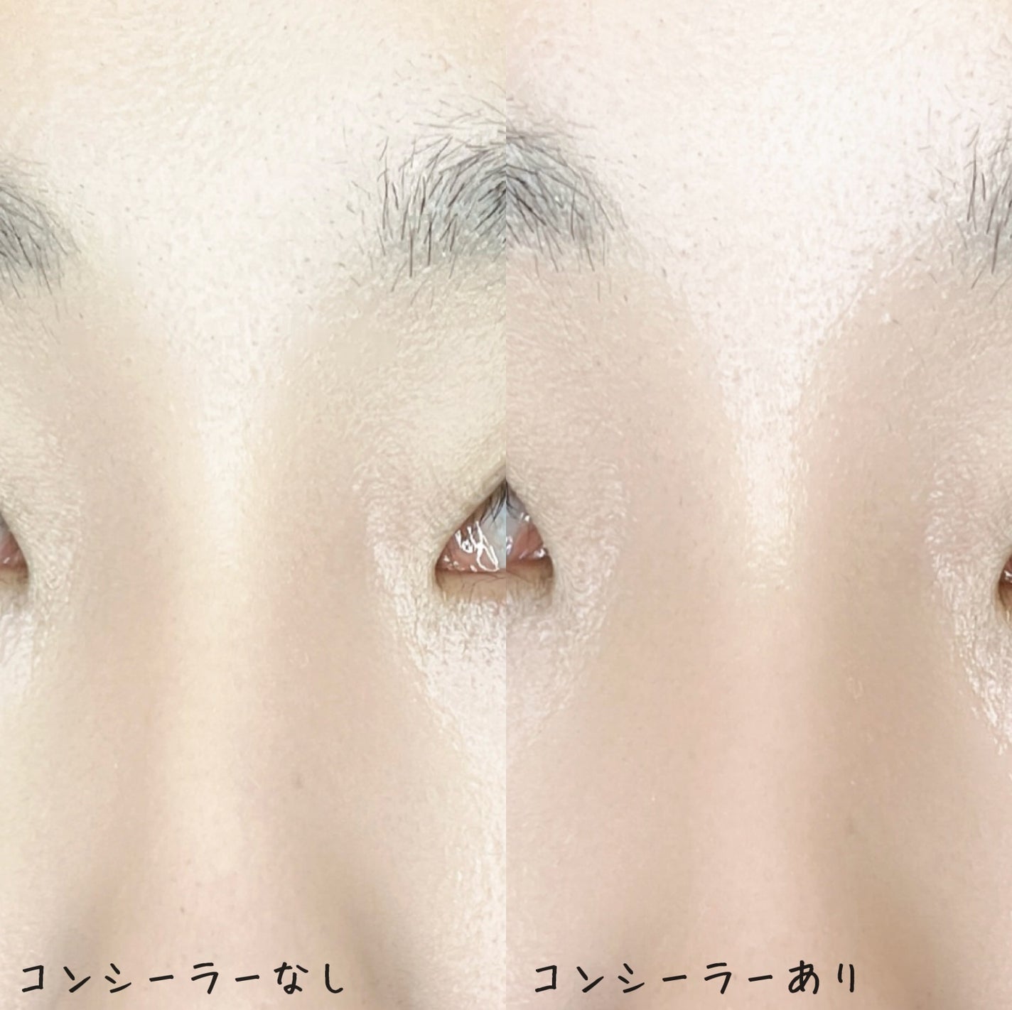 ダーマシンコンシーラー/23years old/リキッドコンシーラーを使ったクチコミ(5枚目)