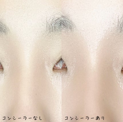 ダーマシンコンシーラー/23years old/リキッドコンシーラーを使ったクチコミ(5枚目)