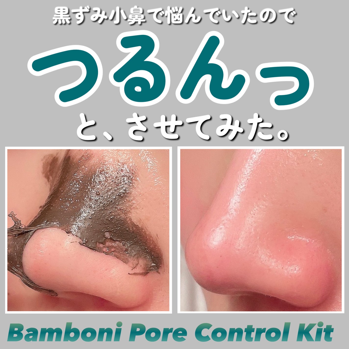 ポア コントロール キット/Bamboni/その他キットセットを使ったクチコミ(1枚目)